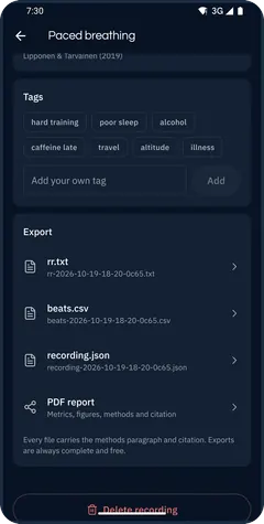 Export: RR .txt, beats CSV, recording JSON and PDF report